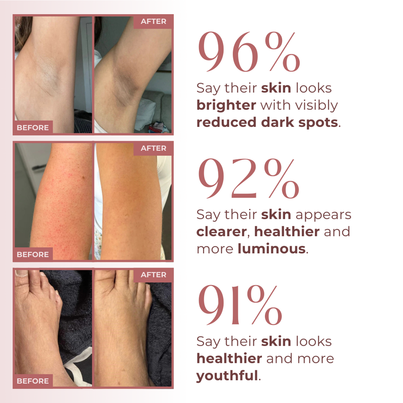 Turmeric Body Peel Spray